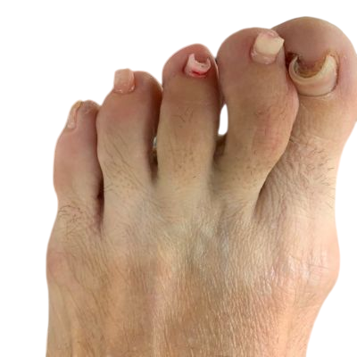 Before Treatment