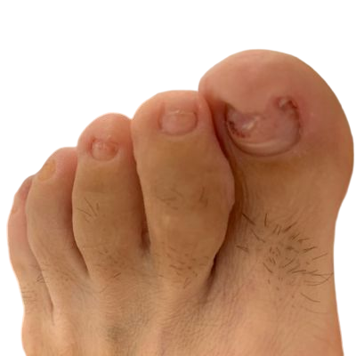 After Treatment