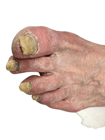 Before Treatment